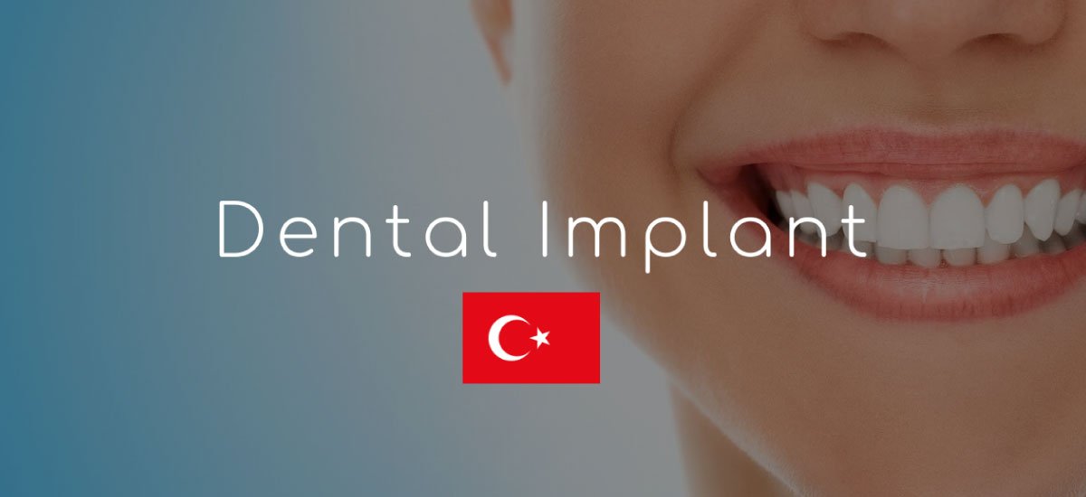 Full Mouth Dental Implants Cost Turkey . - Letsmedi.com