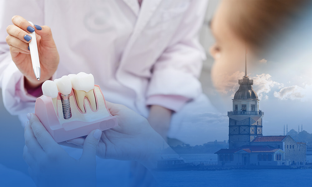 Implant-Step-1 https://letsmedi.com/wp-content/uploads/2020/08/Implant-Step-1.jpg
