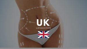 liposuction uk