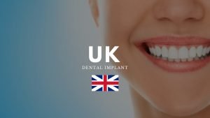 Dental implants UK