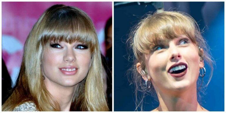 taylor swift veneers before and after