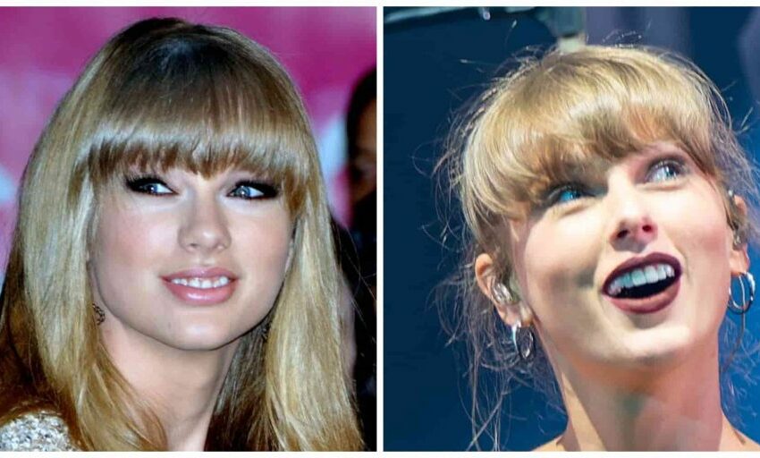 taylor swift veneers before and after